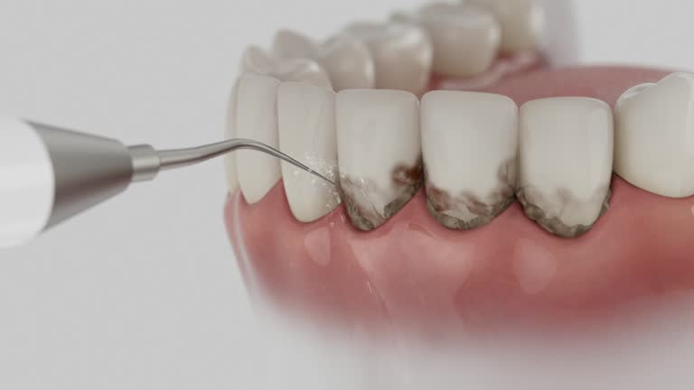 Reliable Dental contractor in Juno Beach, FL by Smile Center Dentistry